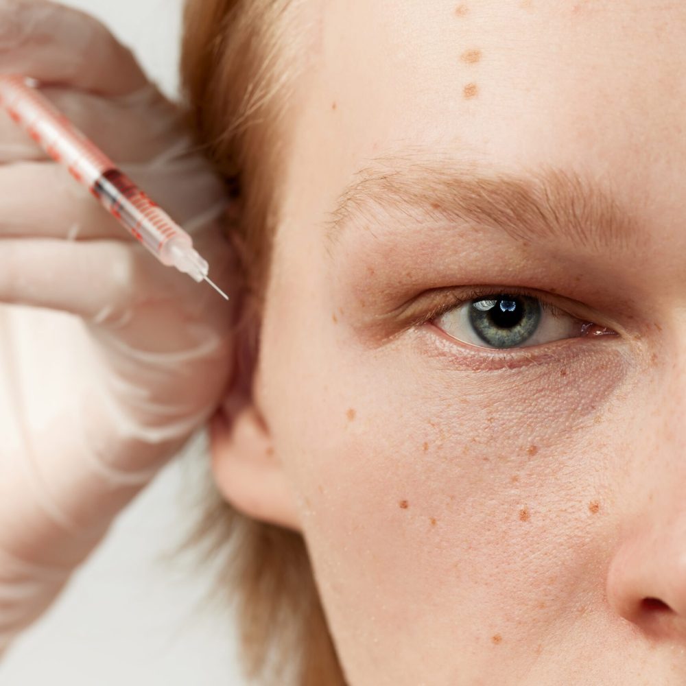 Eye,Lifting.,Young,Redhead,Man,Having,Cosmetological,Injections.,Male,Model